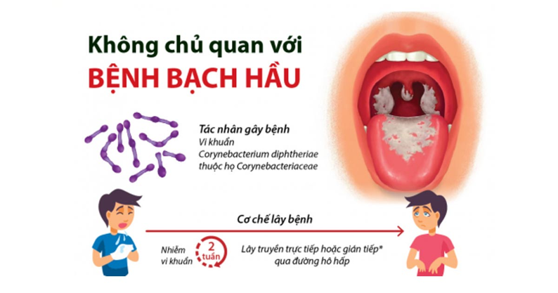 bệnh bạch hầu