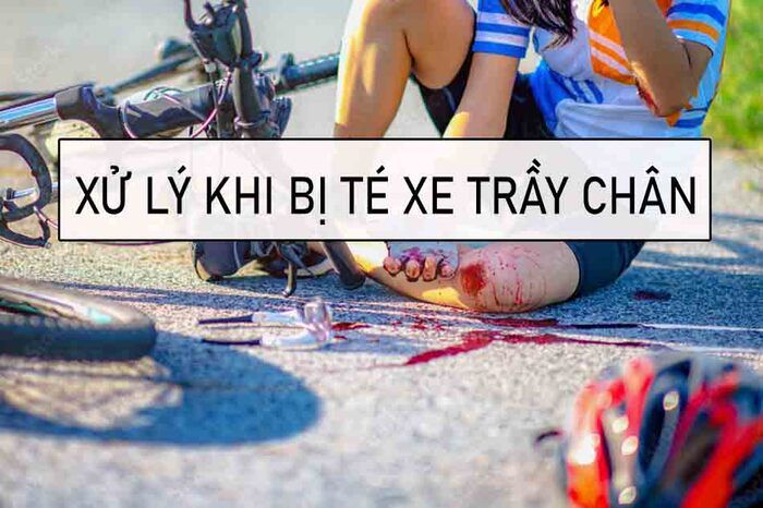 bị té xe trầy chân bôi thuốc gì