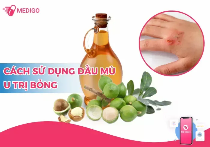 dầu mù u trị bỏng hiệu quả