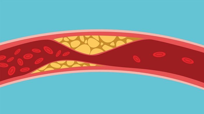 cholesterol và triglyceride