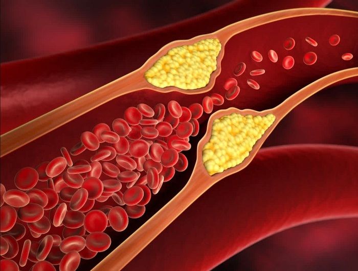 cholesterol và triglyceride