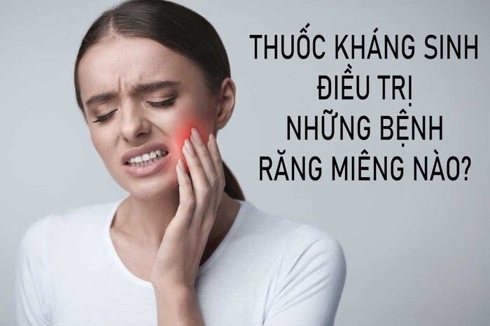 thuốc kháng sinh răng