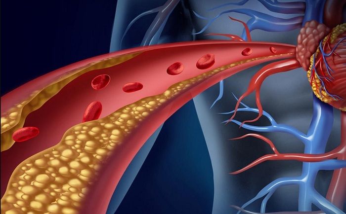 uống gì để giảm cholesterol